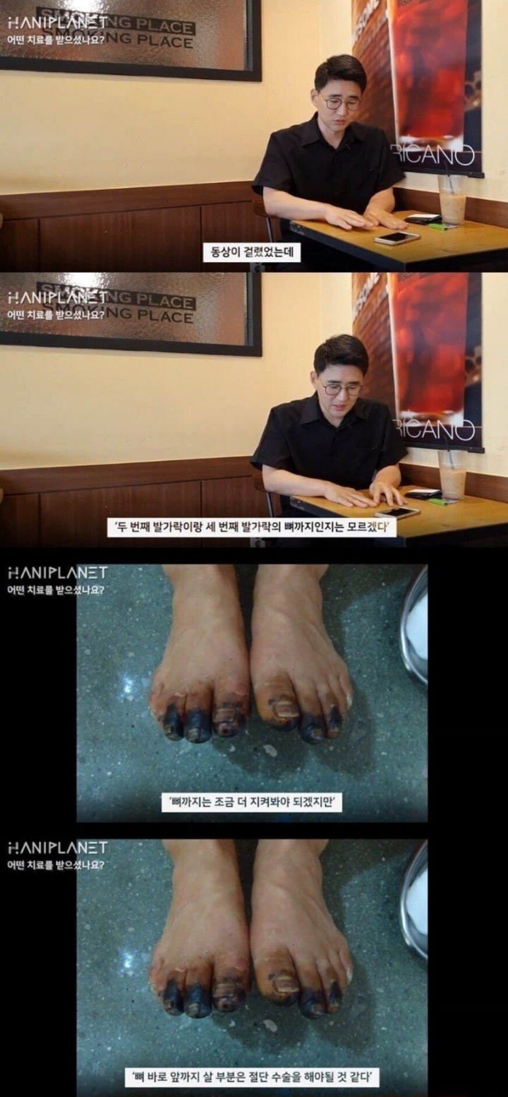 한의원 동상 치료 논란 본인 인터뷰.jpg | 인스티즈