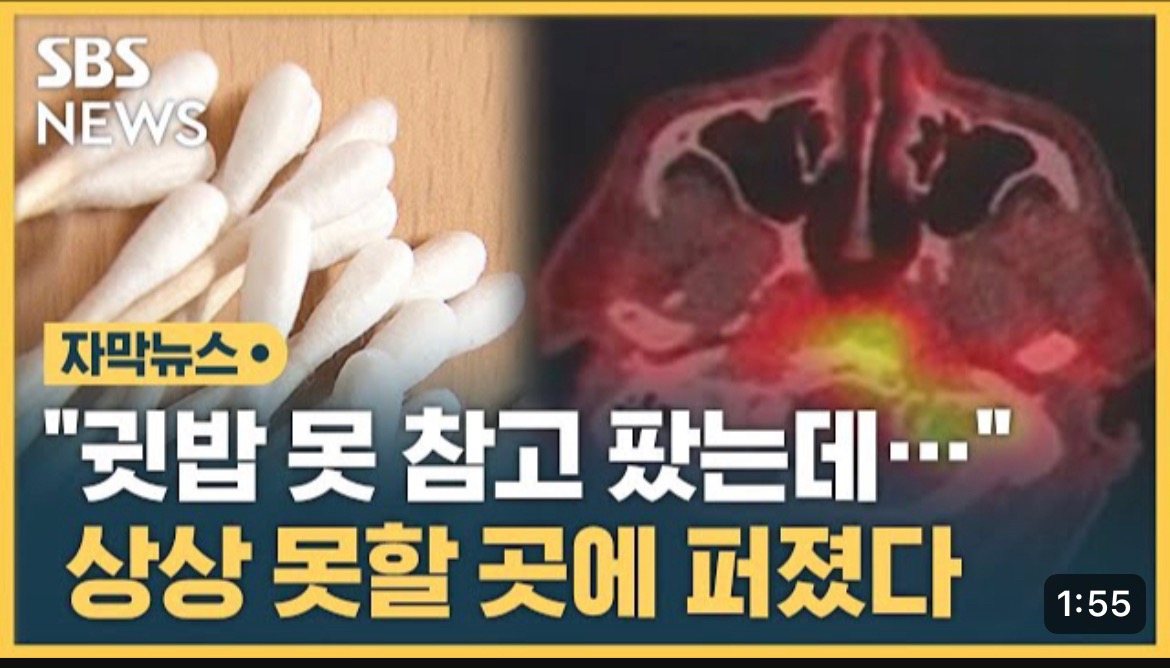 [SBS뉴스] "귓밥 못 참고 팠는데…” 상상도 못할 곳에 퍼졌다 | 인스티즈