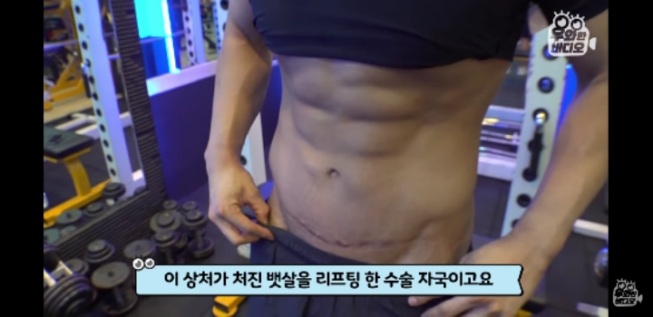 150키로 초고도비만 남자 5년만에 | 인스티즈