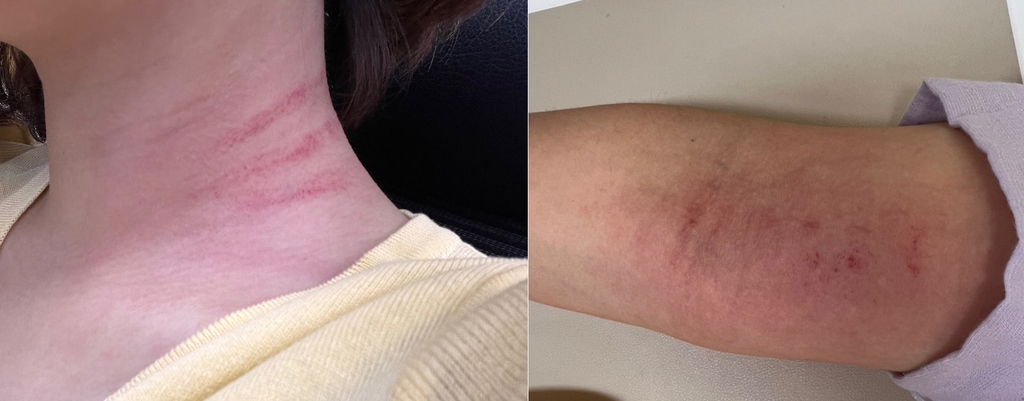 머리채 잡힌 선생님…인천서도 초등학생이 교사 폭행 | 인스티즈