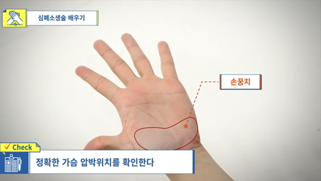 사람이 쓰러졌어요! 의식이 없어요! 우리 강아지가 쓰러져서 일어나지 않아요! 살려주세요!! | 인스티즈