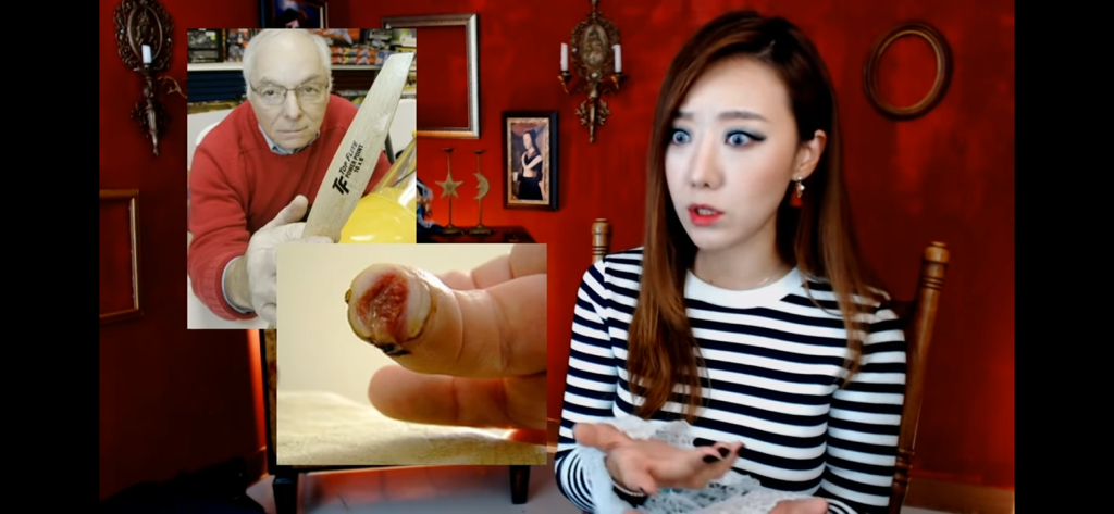 돼지 방광으로 잘린손가락 재생사례(손가락사진 주의) | 인스티즈