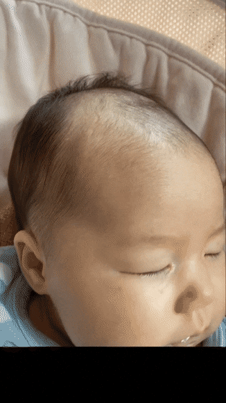 아기 머리에 있는 숨구멍 .gif | 인스티즈