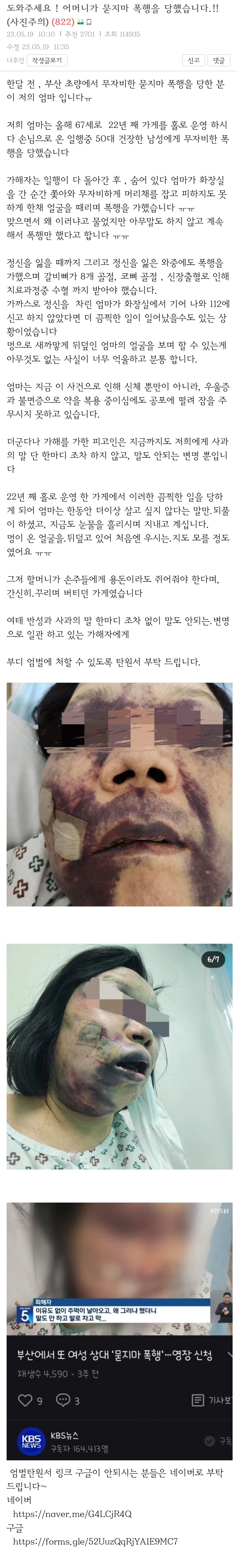 도와주세요! 어머니가 묻지마 폭행을 당했습니다.!!(사진주의) | 인스티즈
