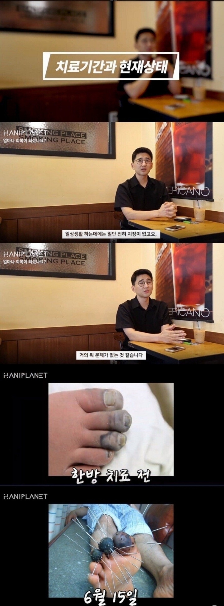 한의원 동상 치료 논란 본인 인터뷰.jpg | 인스티즈