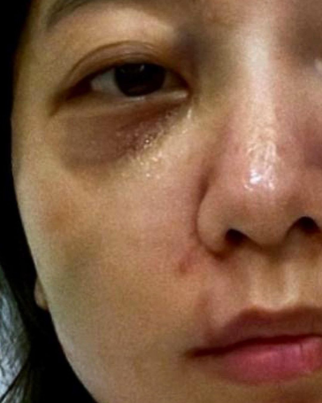 '결혼과이혼사이' 남편한테 폭행당했다는 서사랑 인스타 입장문.jpg (사진 트리거 주의) | 인스티즈