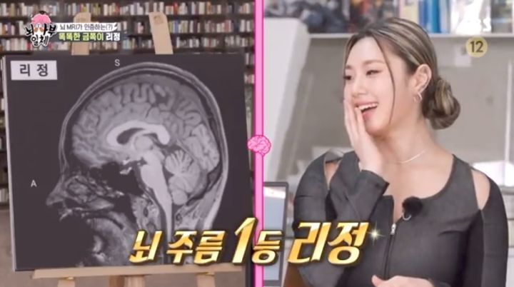 [집사부일체] 최고의 뇌과학자가 분석한 양세형, 리정, 이승기, 유수빈, 김동현 뇌 MRI 결과 | 인스티즈