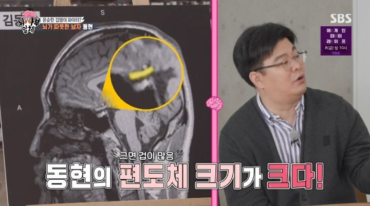 [집사부일체] 최고의 뇌과학자가 분석한 양세형, 리정, 이승기, 유수빈, 김동현 뇌 MRI 결과 | 인스티즈