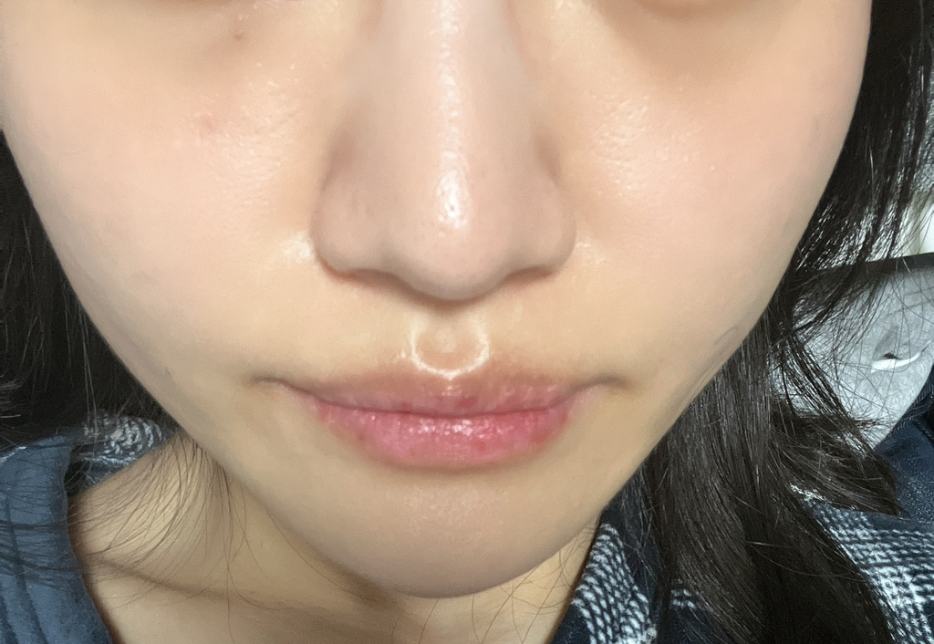 영슈퍼 이미지