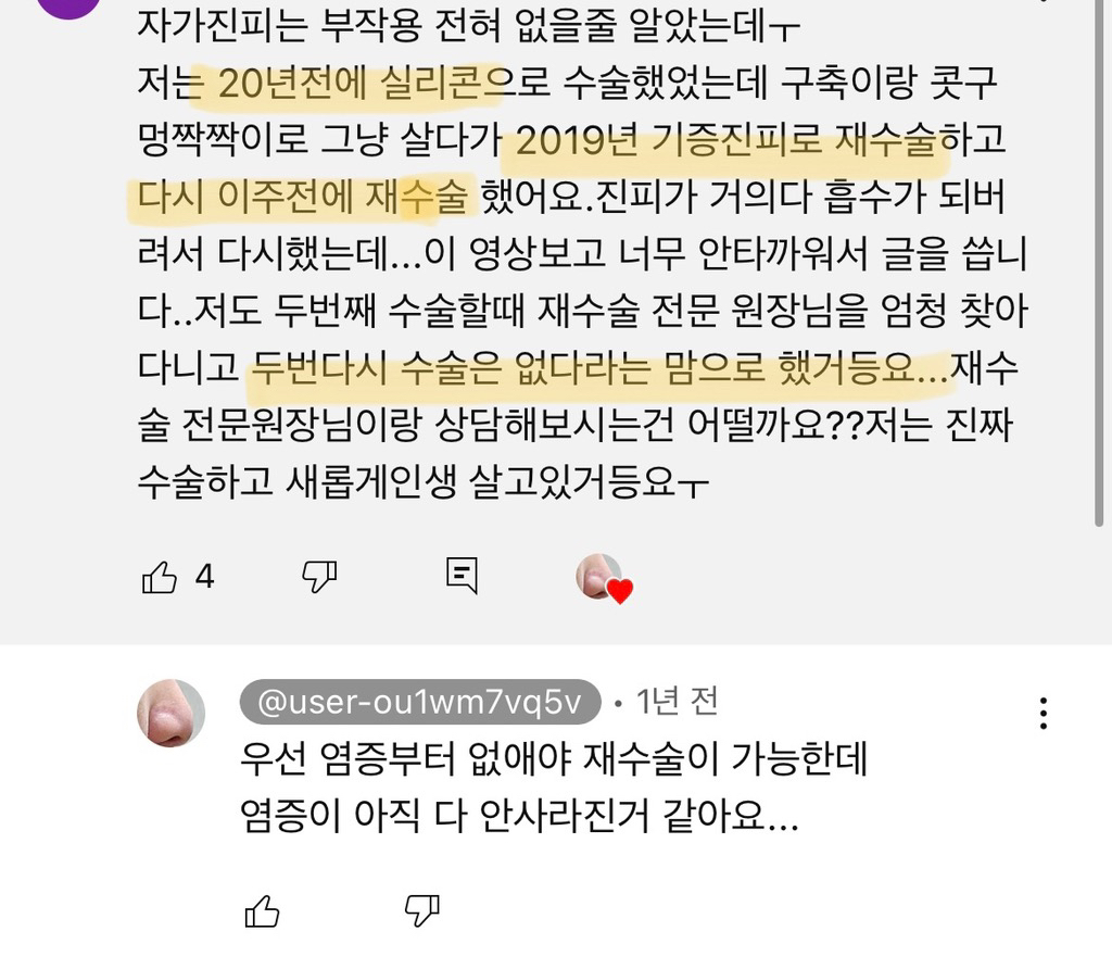 코수술 부작용으로 인한 코끝 꺼짐 + 자가진피 코수술 후기 | 인스티즈