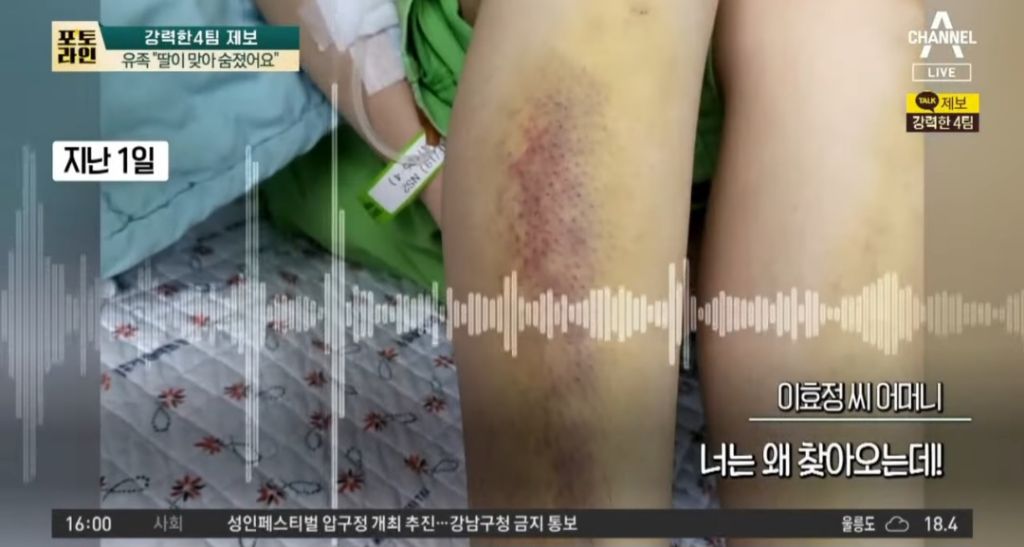 유족이 얼굴 공개한 전남친 폭행으로 사망한 여성 | 인스티즈