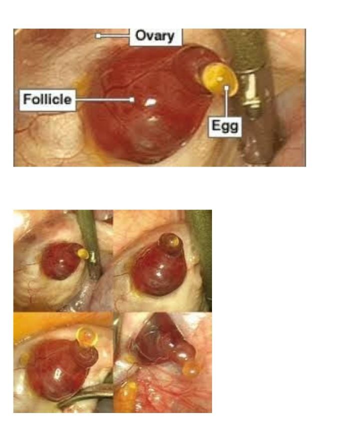 배란통이 있는 이유.jpg (사진 주의) | 인스티즈