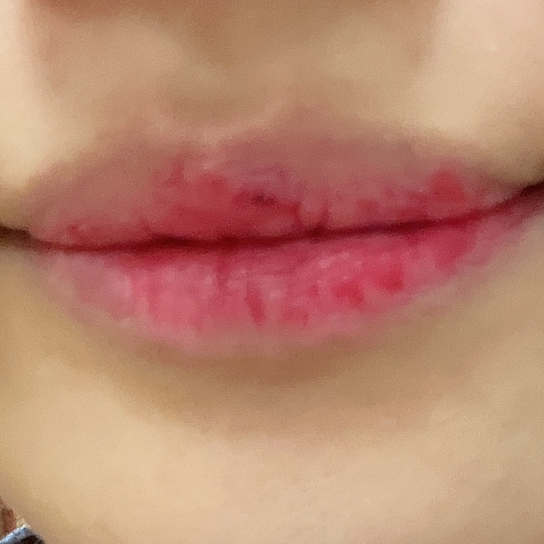 블러썸 이미지