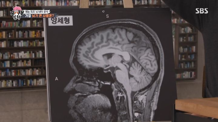 [집사부일체] 최고의 뇌과학자가 분석한 양세형, 리정, 이승기, 유수빈, 김동현 뇌 MRI 결과 | 인스티즈