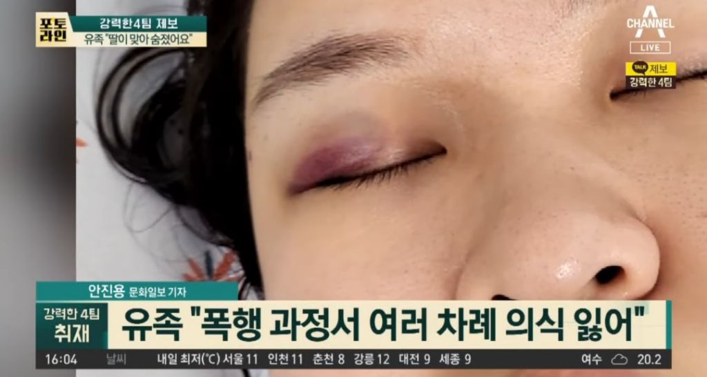 유족이 얼굴 공개한 전남친 폭행으로 사망한 여성 | 인스티즈