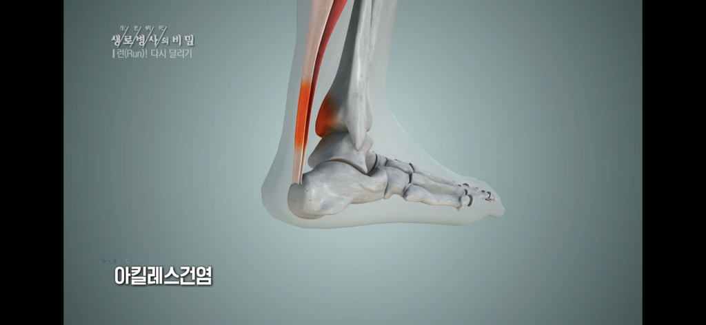 999e015bb59d00da08e48ae4a3c8105dabe5355f