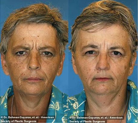 쌍둥이인데 확연히 차이 나는 외모… 이 중 누가 흡연자일까요? | 인스티즈