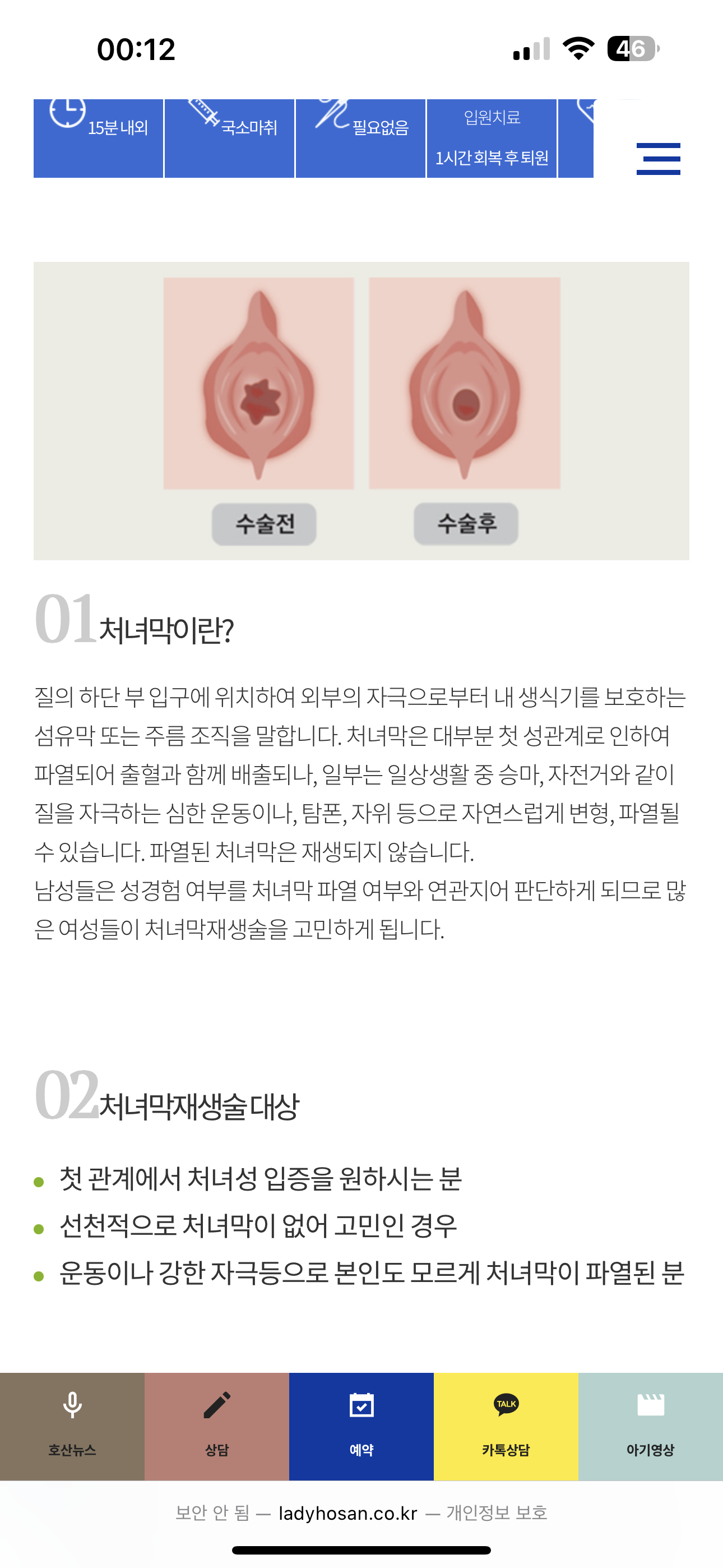 처녀막 재생수술 받은 사람 | 인스티즈