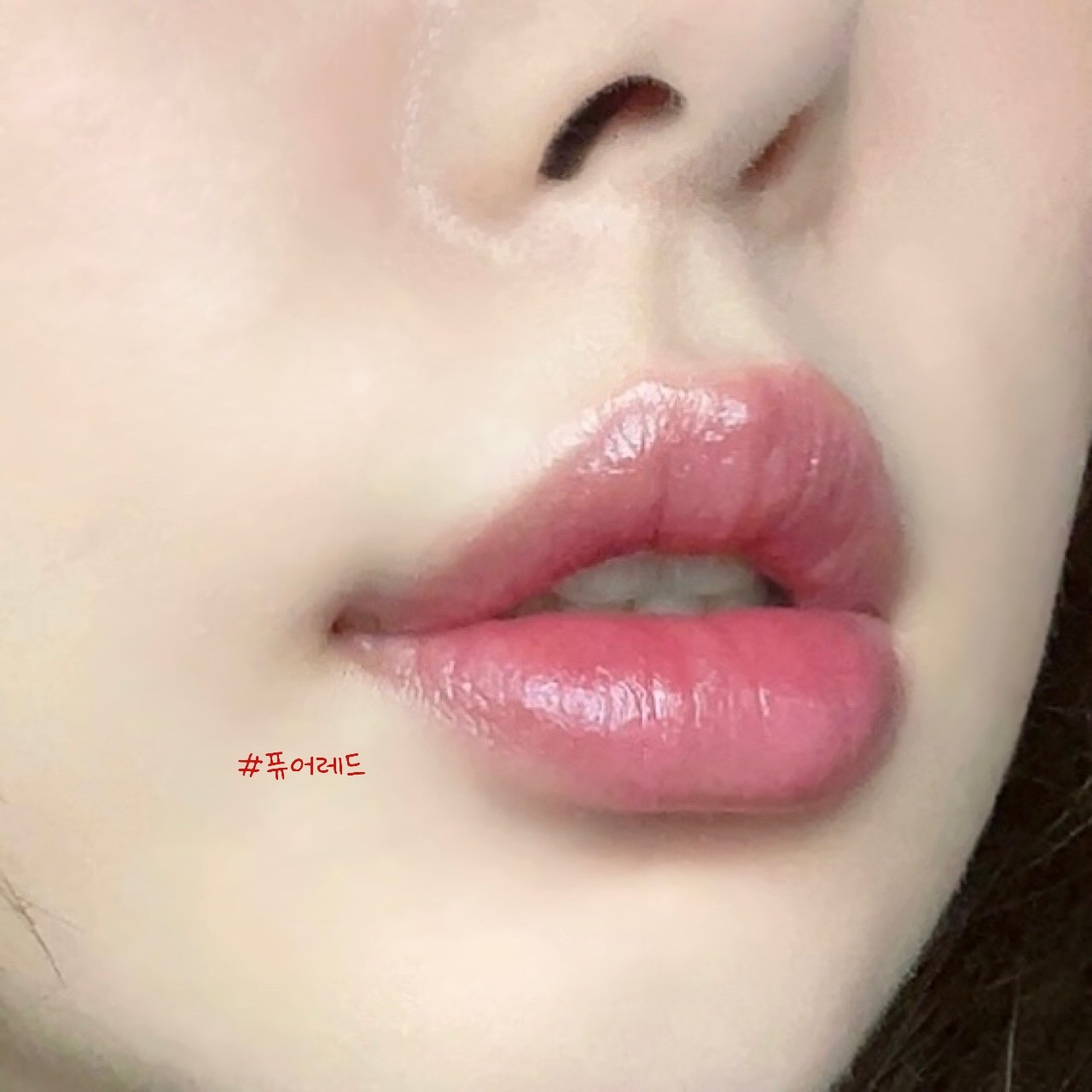 뉴로즈 이미지