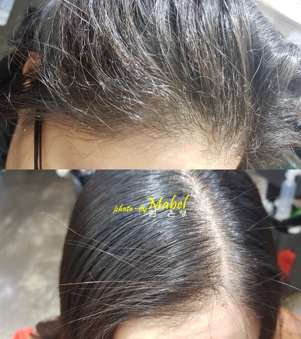 이런 곱슬 가진 사람 은근 있음.jpg | 인스티즈