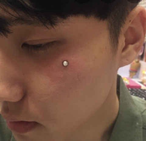 피부에 아예 박아버리는 "더멀 피어싱” | 인스티즈