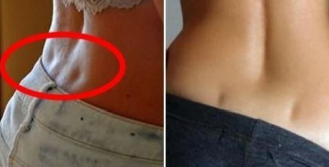 해외에서 유행하다가 우리나라에서도 시행하는 성형부위.jpg | 인스티즈