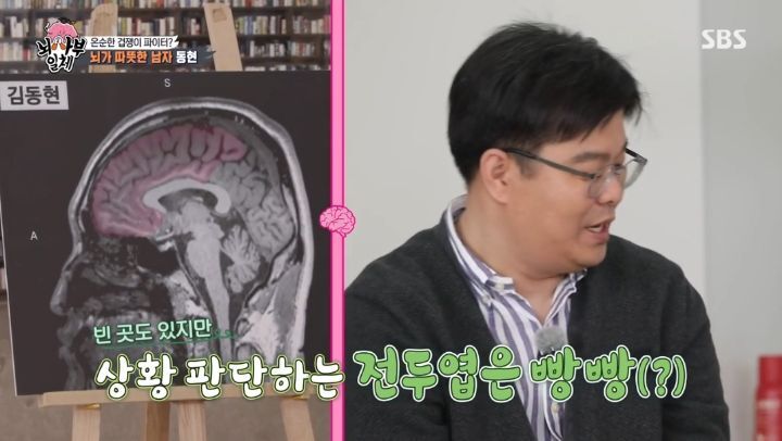 [집사부일체] 최고의 뇌과학자가 분석한 양세형, 리정, 이승기, 유수빈, 김동현 뇌 MRI 결과 | 인스티즈