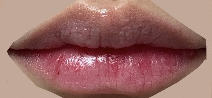 블러썸 이미지