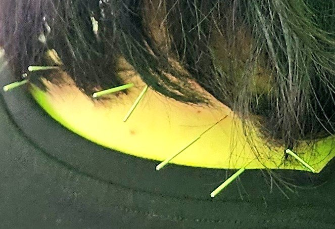 락페에 한의사가 왜..? | 인스티즈