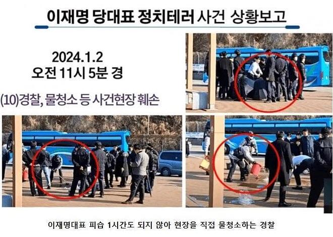 이재명 칼테러 사건의 상처크기 | 인스티즈