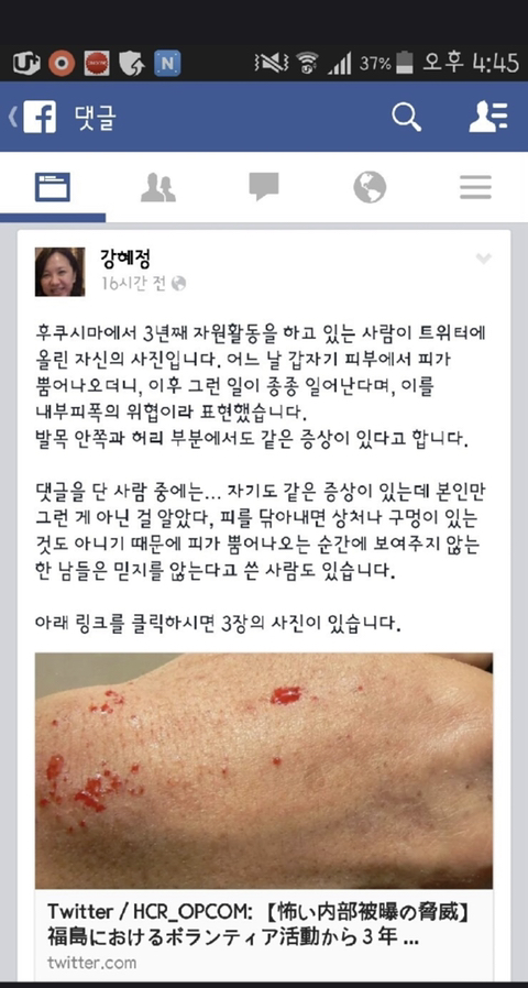 방사능에 피폭되면 어떻게 될까 궁금해서 찾아봄 | 인스티즈