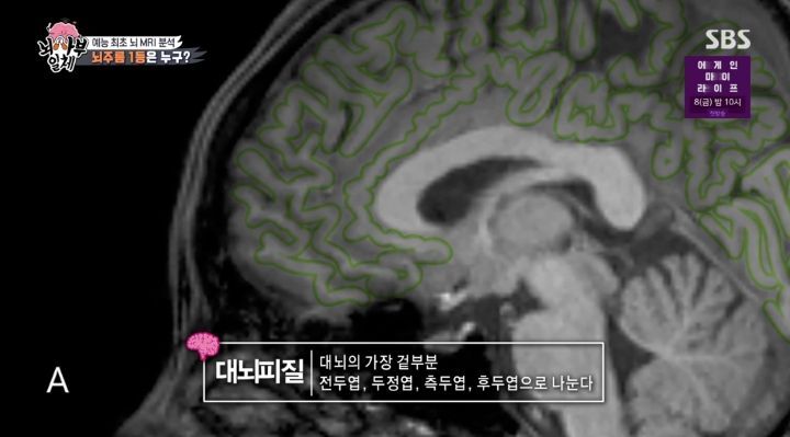 [집사부일체] 최고의 뇌과학자가 분석한 양세형, 리정, 이승기, 유수빈, 김동현 뇌 MRI 결과 | 인스티즈