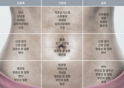 부위별 복통 원인 및 관련 질병 | 인스티즈