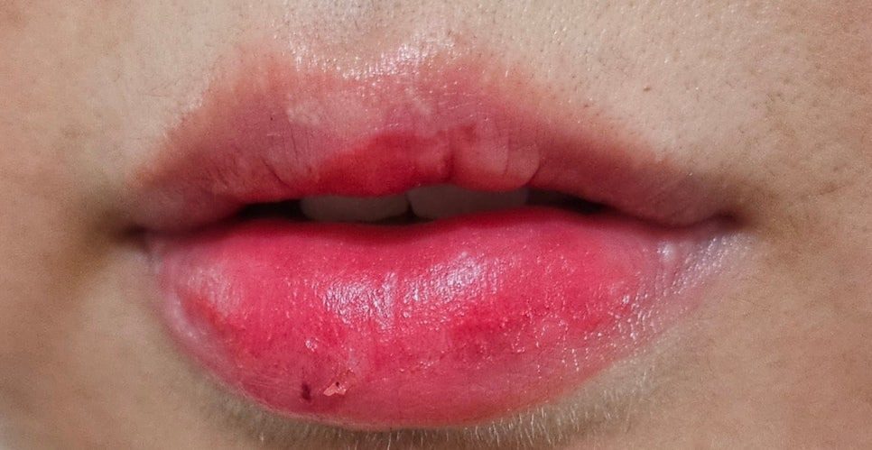 블러썸 이미지