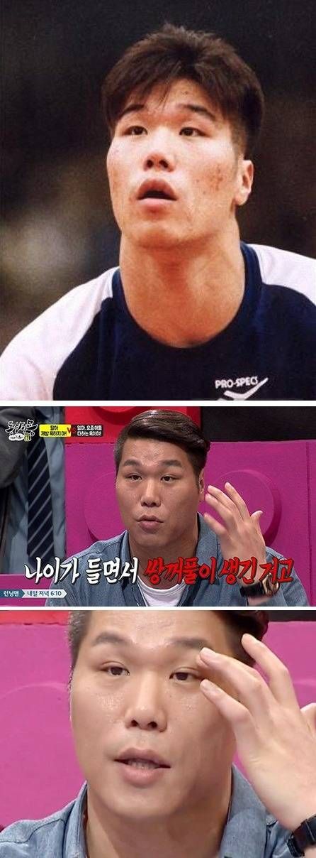 은근히 많이 생긴다는 '후천적 쌍꺼풀' | 인스티즈