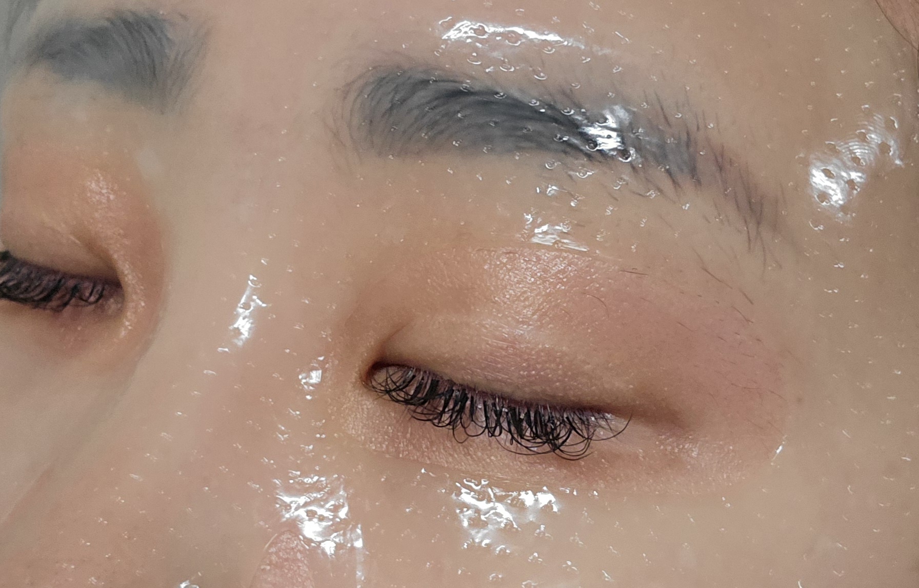 건성 이미지