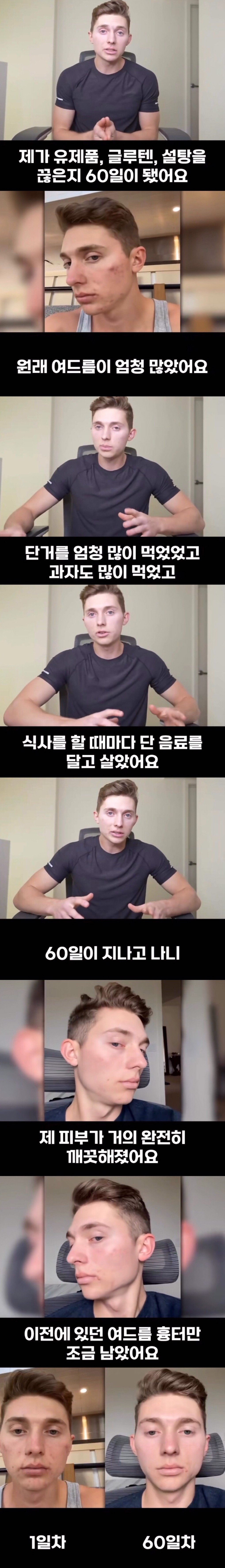 피부과 안가고 꿀피부 되는 방법.jpg | 인스티즈