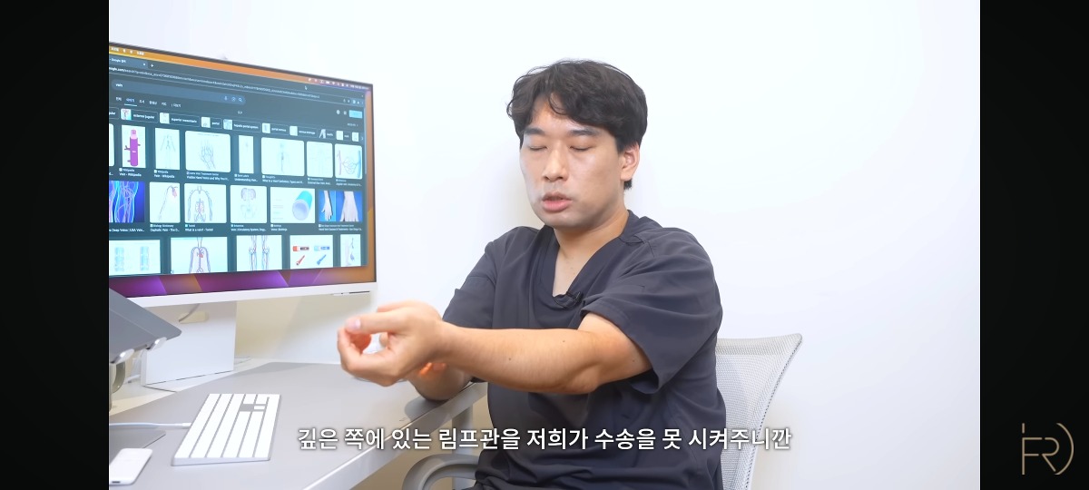 의사가 말하는 종아리 마사지(기계) 하지말아야하는 이유.jpg | 인스티즈