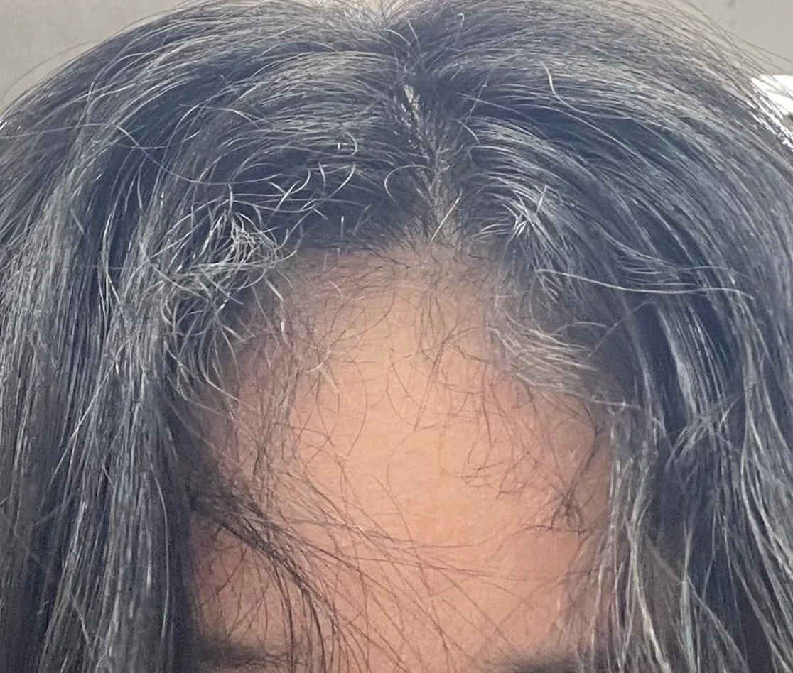 이런 곱슬 가진 사람 은근 있음.jpg | 인스티즈