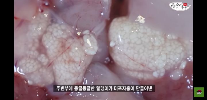 아귀 알인줄 알았는데 알고보니 기생충?.youtube | 인스티즈