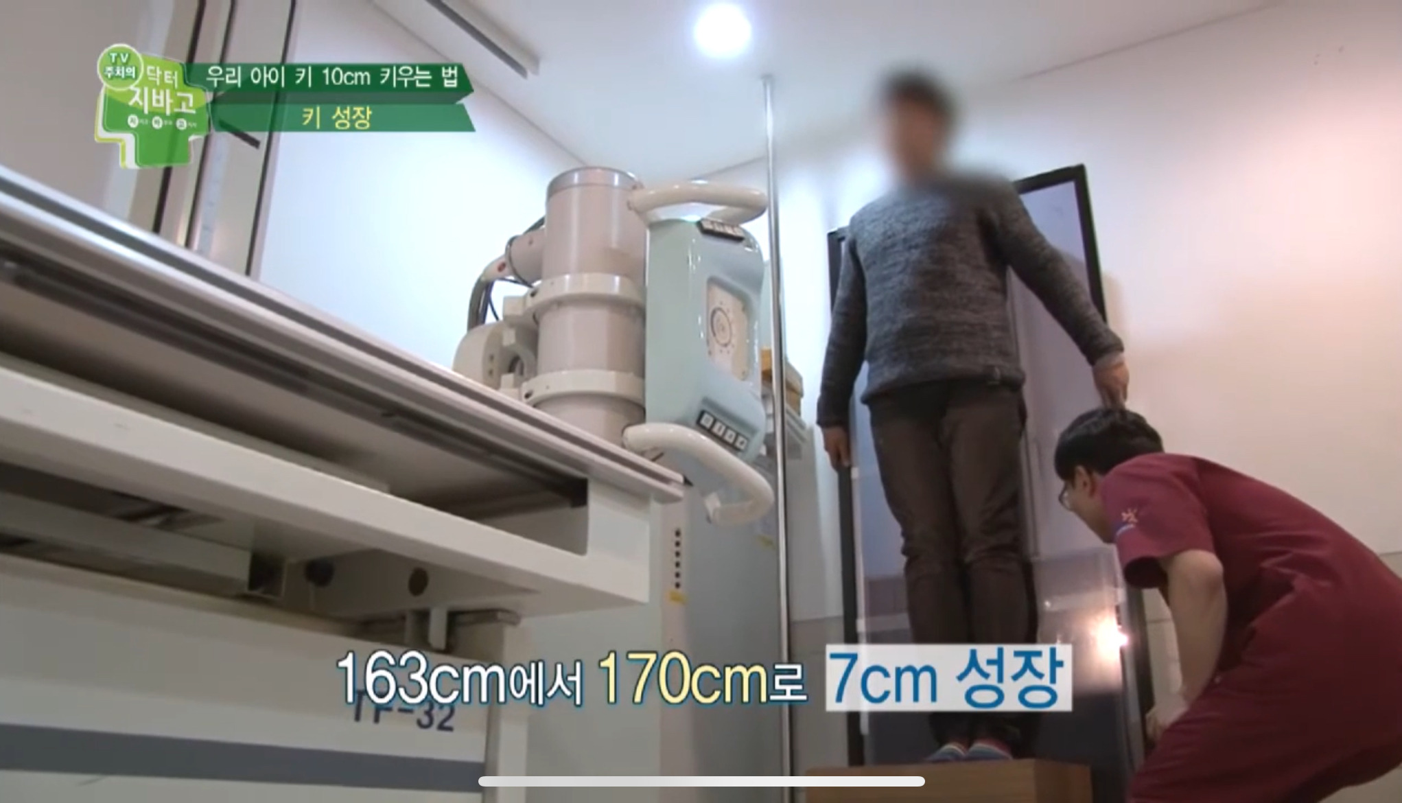 163 ➡️ 170으로 7cm 늘리는 수술했는데… | 인스티즈