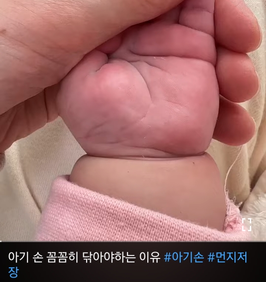 통통한 애기 손목 꼼꼼히 닦아야하는 이유 | 인스티즈