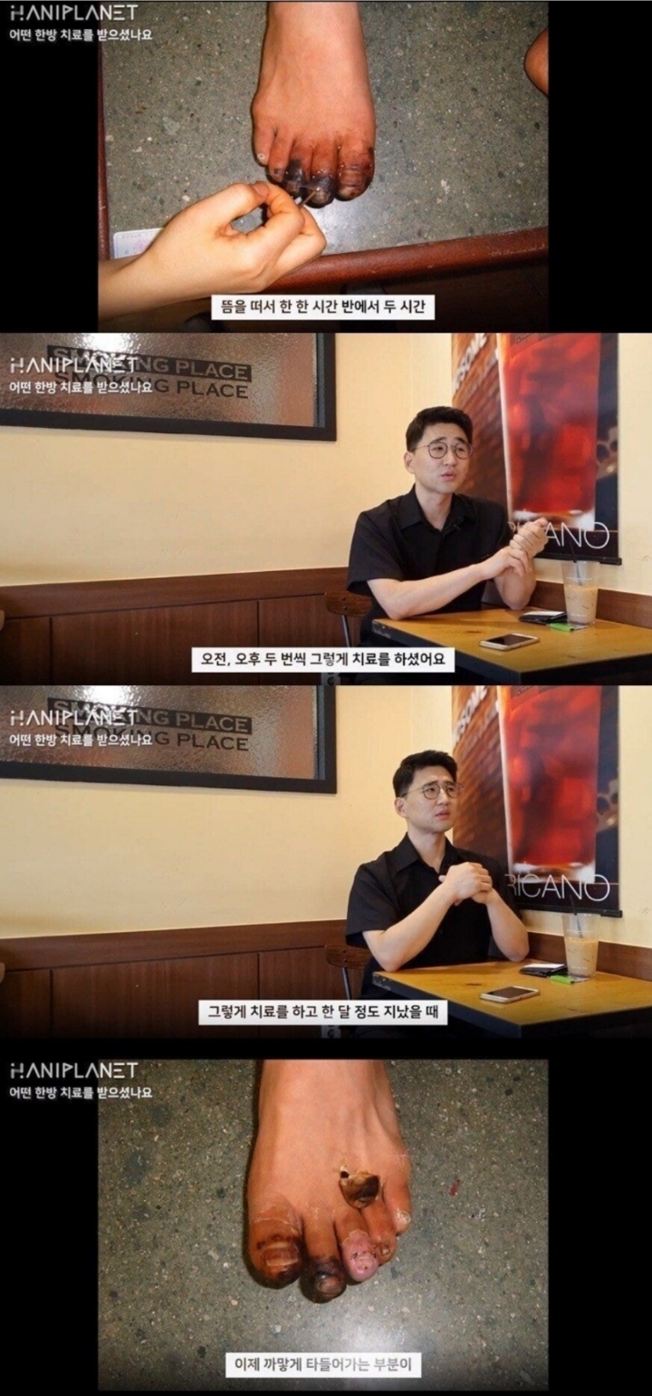 한의원 동상 치료 논란 본인 인터뷰.jpg | 인스티즈