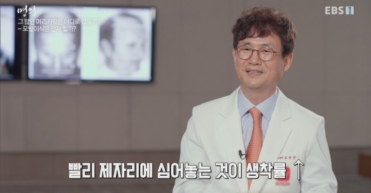 (주의) 실제 모발이식 장면.gif | 인스티즈