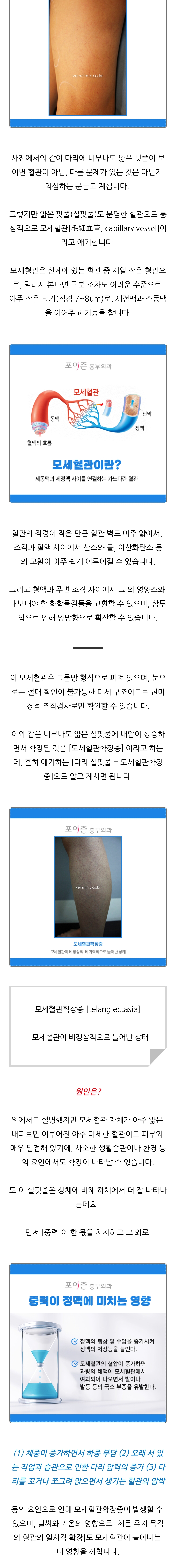 다리에 얇은 핏줄이 보여요!모세혈관확장증 | 인스티즈