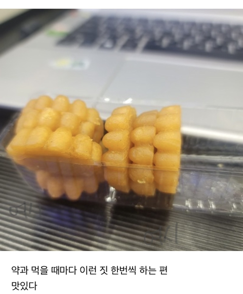 이가 좀 누런 편인가? | 인스티즈