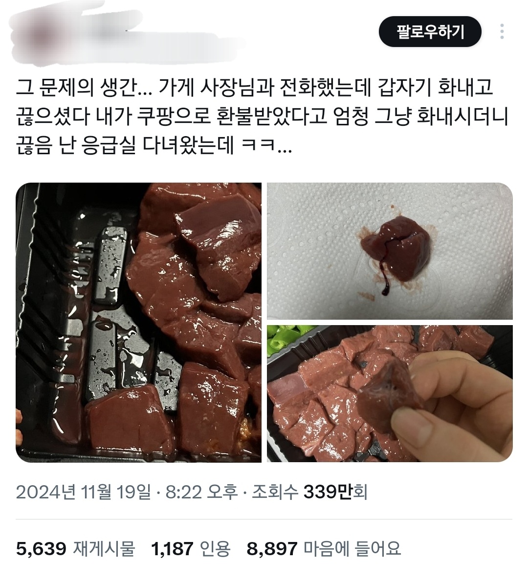 님들아 생간 처음 먹었는데 시큼하고 울렁거림 이 생간 문제있음..??.twt | 인스티즈