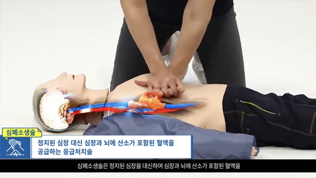 사람이 쓰러졌어요! 의식이 없어요! 우리 강아지가 쓰러져서 일어나지 않아요! 살려주세요!! | 인스티즈