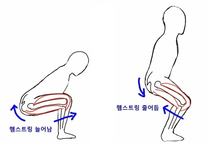다리 쫙 안펴지세요? 피려하면 덜덜 떨리세요? | 인스티즈