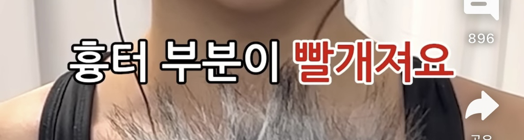 코수술 부작용 이야기 + 댓글 부작용 후기 | 인스티즈